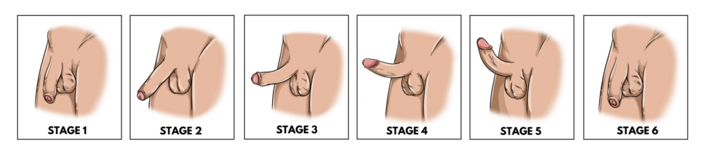 Six stages of getting erect, from soft to fully hard and back again.