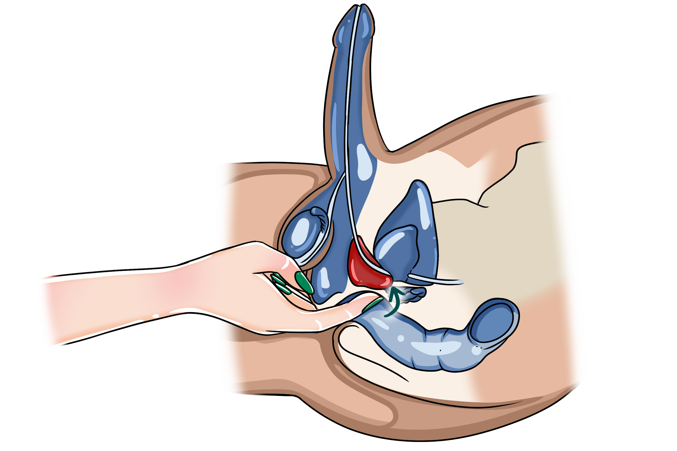Massage Move #1 – The “Come Here” Finger Curl Ivy performs prostate massage with a gentle come-hither curl.