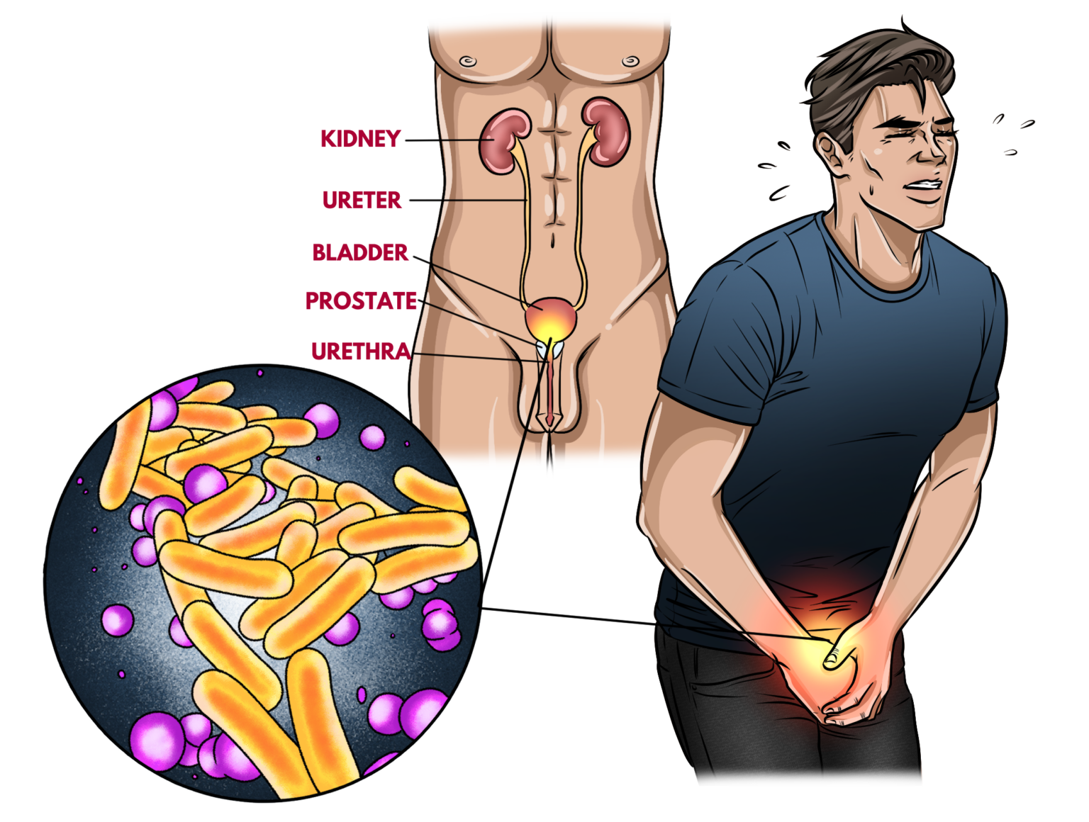 Can Sex Cause UTI? Yes & Here’s What You Need To Know - School Of Squirt