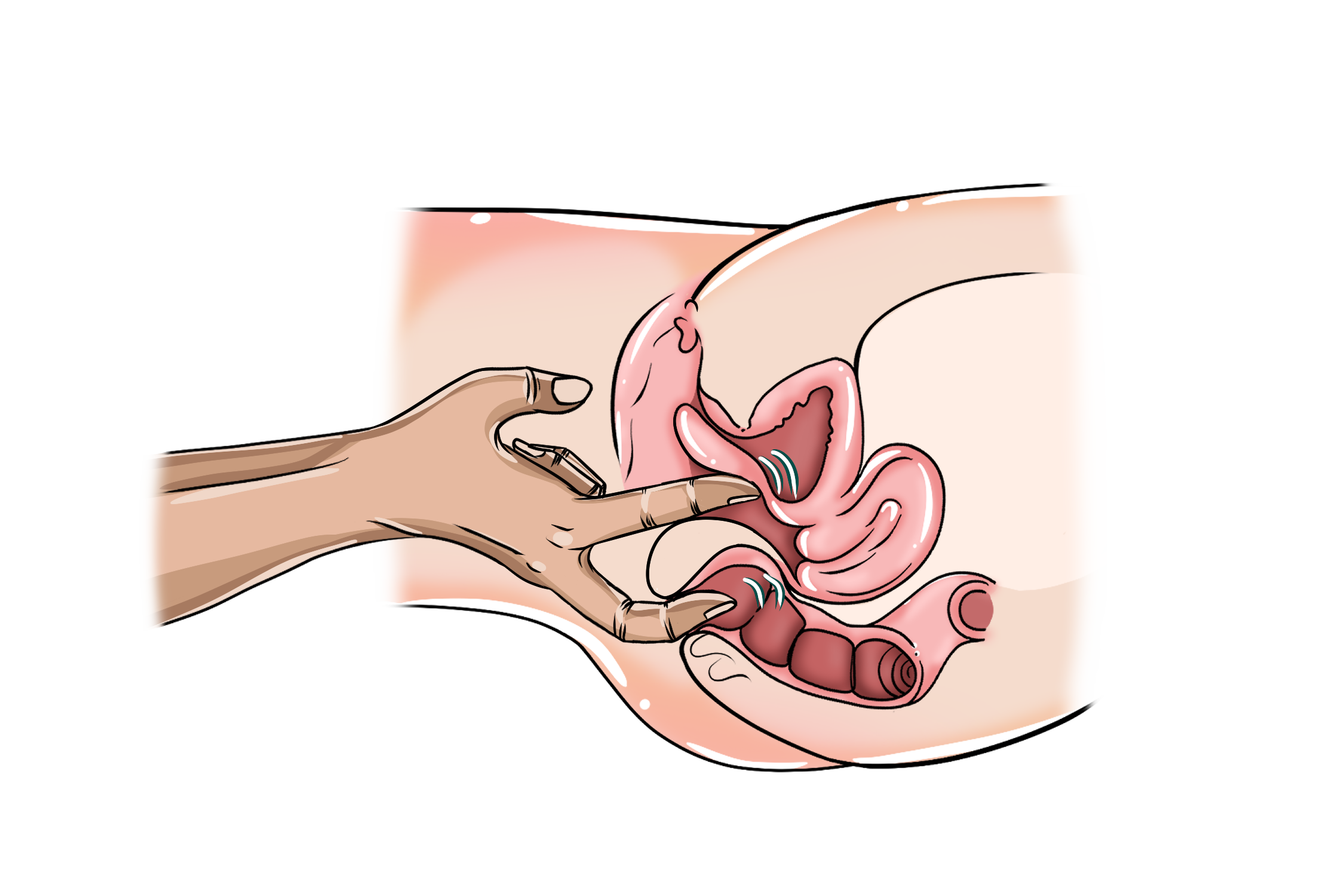 Technique #11 – Double Trouble G-spot massage diagram showing one finger against the front vaginal wall and another at the anus.