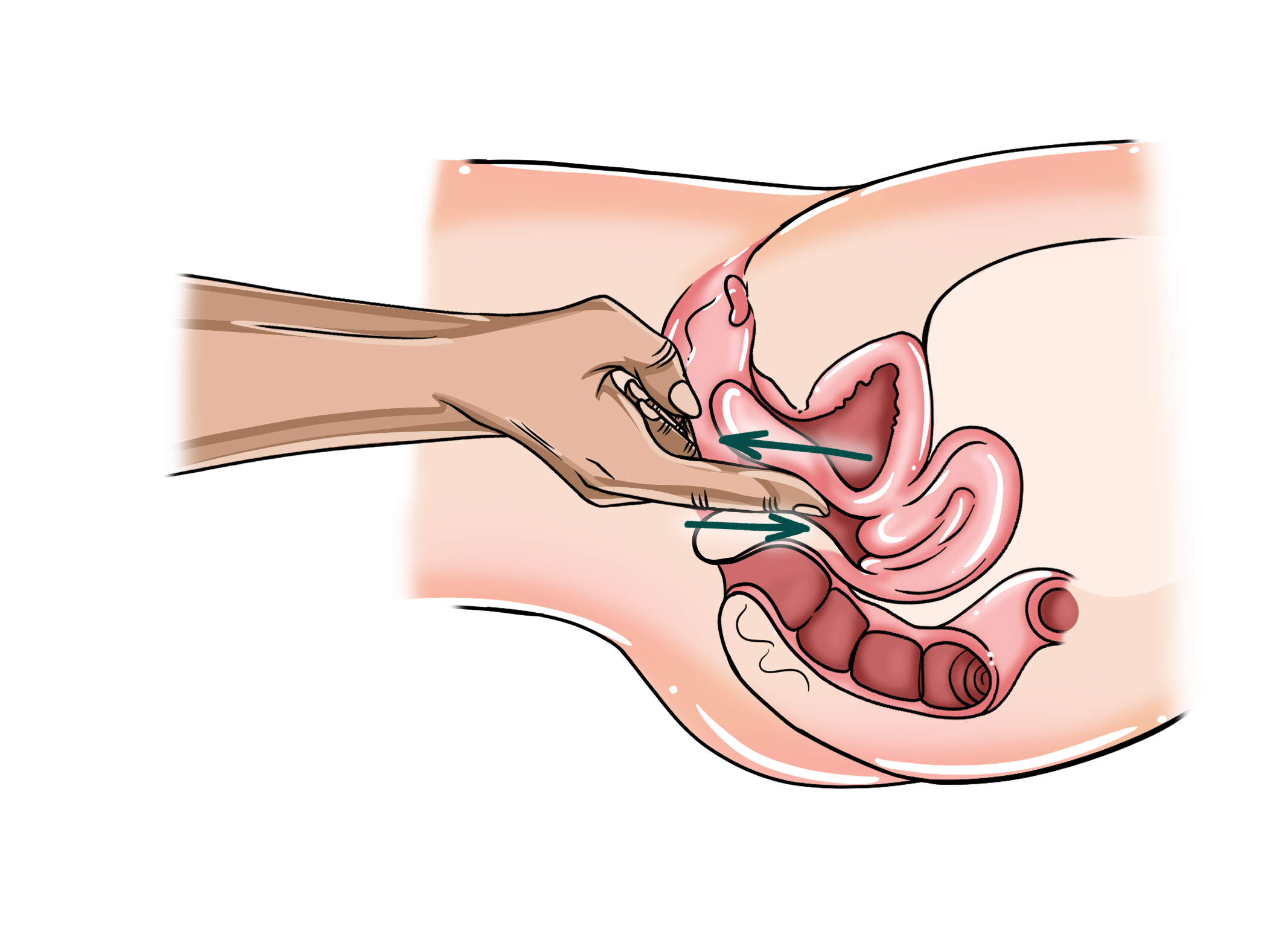 Technique #18 – Slow Release G-spot massage diagram showing fingers inside the vagina with arrows indicating withdrawal.