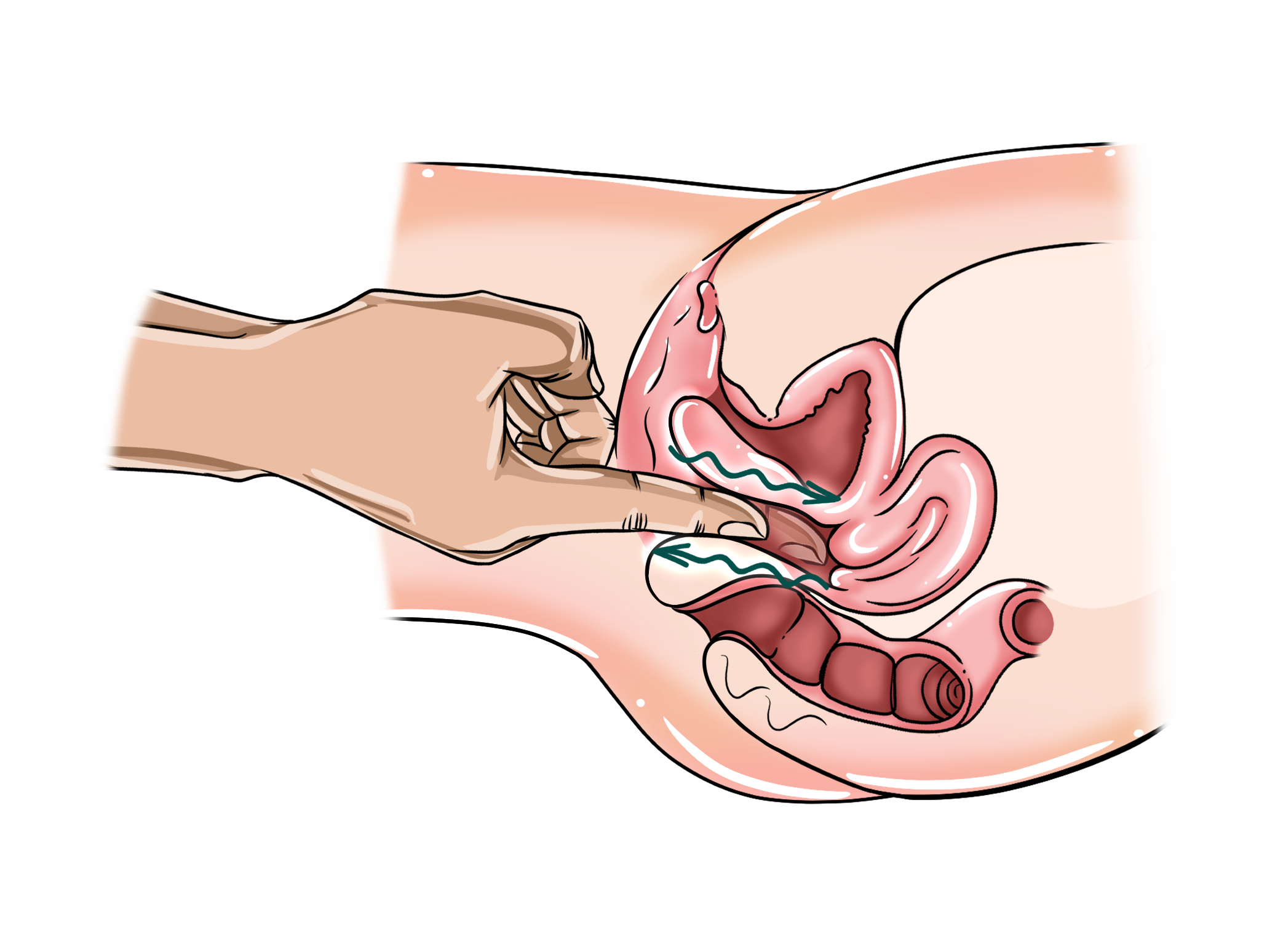 Technique #2 – G-Spot Slider G-spot massage cross-section showing a finger inside the vagina with arrows indicating a sliding motion.