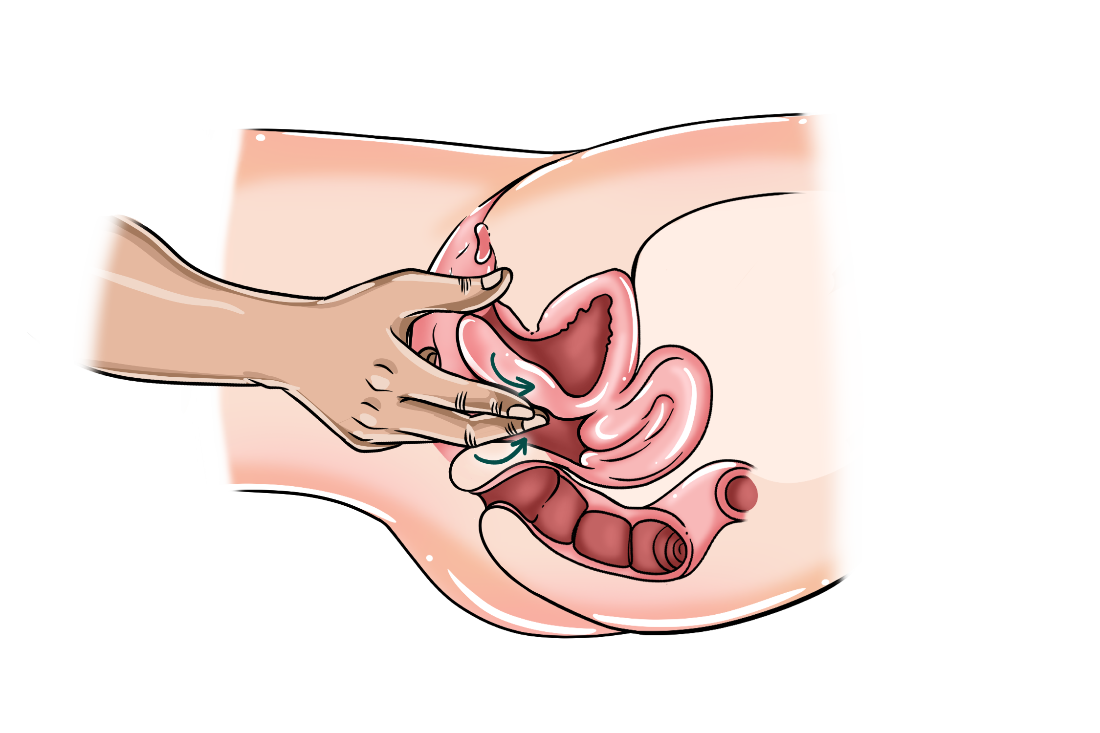 Technique #4 – G-Spot Walker G-spot massage diagram showing two fingertips alternating contact along the front vaginal wall.